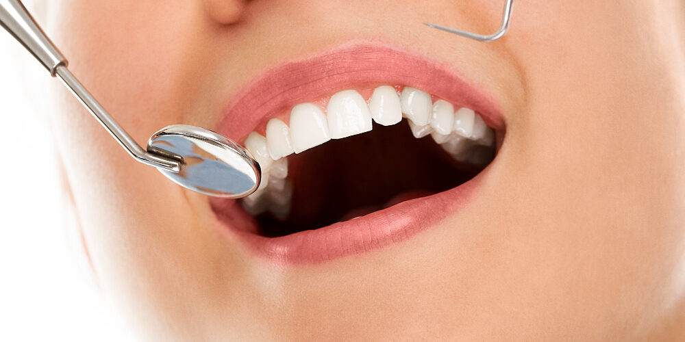 Ce trebuie sa stii despre aparatele dentare pentru un zambet increzator2